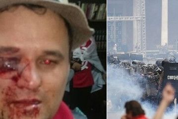 Foto: