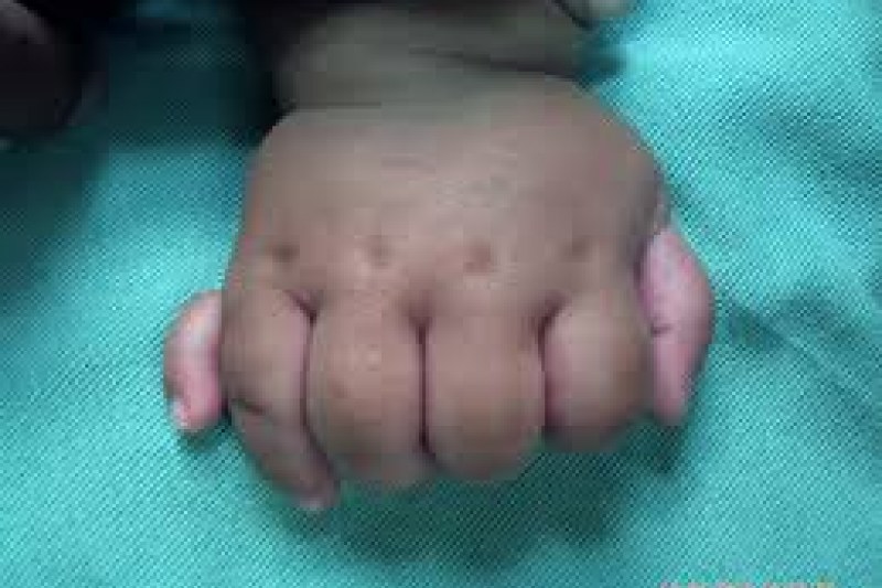 Foto: